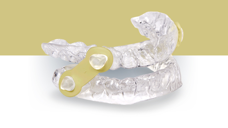 Mandibular Advancement Device (MAD)