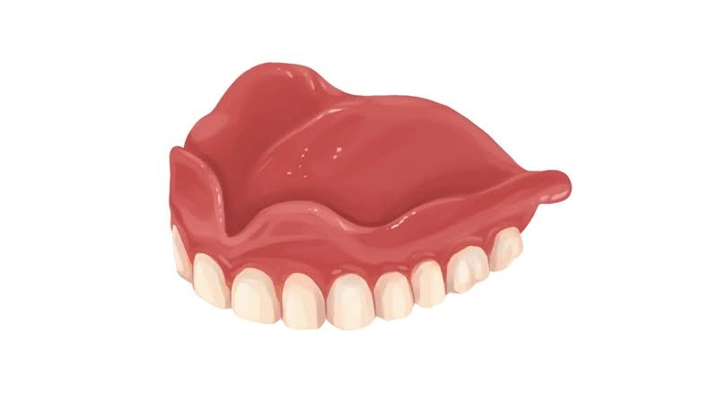 Denture without palate