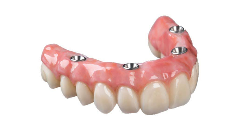 Complete Denture without Palate | Aesthetic Dental Clinic